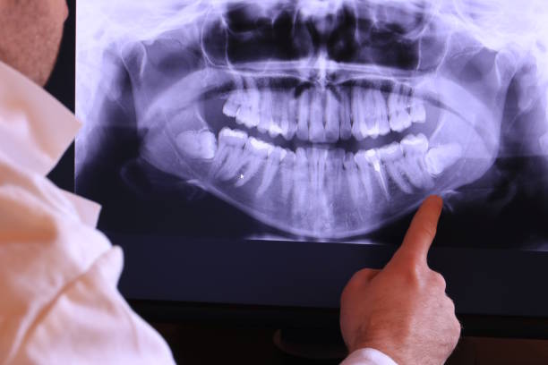 Best Emergency Dental Extractions in Iola, KS