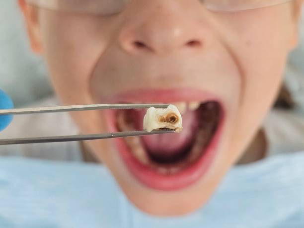 Best Urgent Dental Care for Toothache in Iola, KS